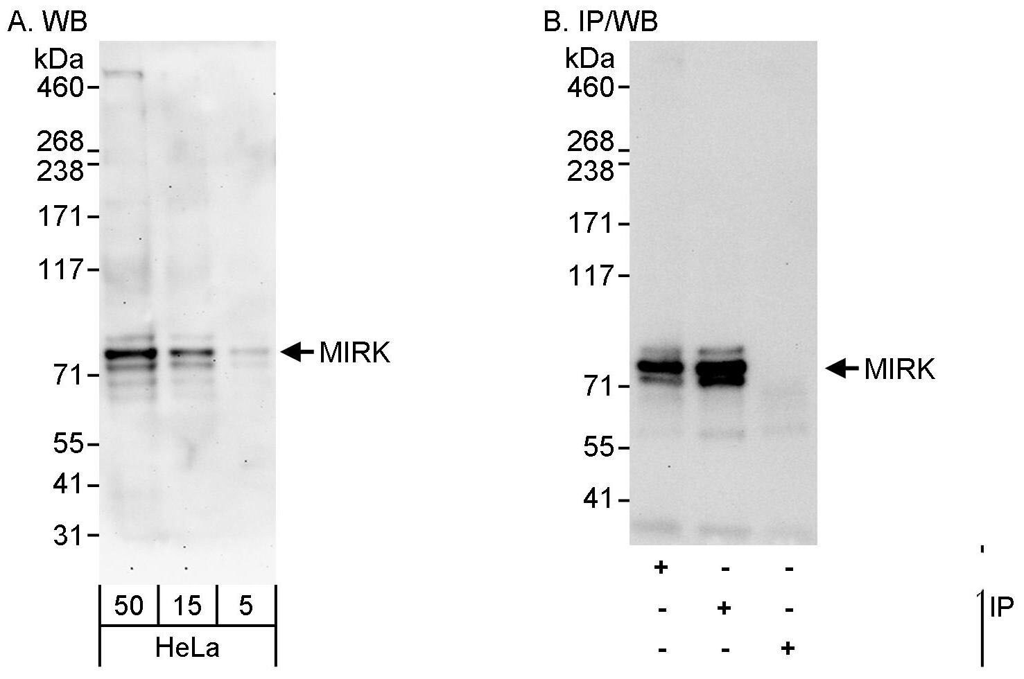 Dyrk1B Antibody