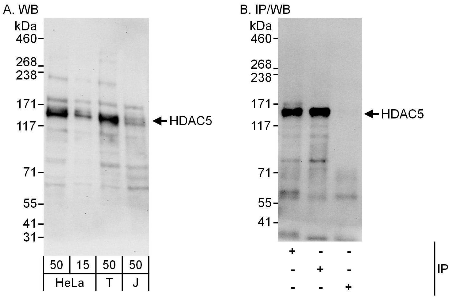 HDAC5 Antibody