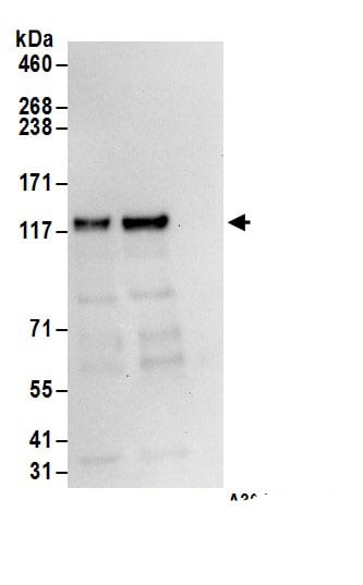 ROR2 Antibody