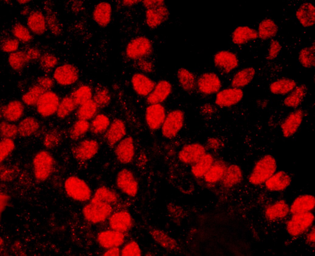 HMGN1/HMG14 Antibody