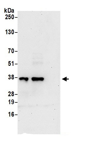 SUCLG1 Antibody