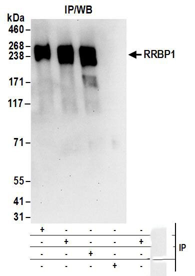 RRBP1 Antibody