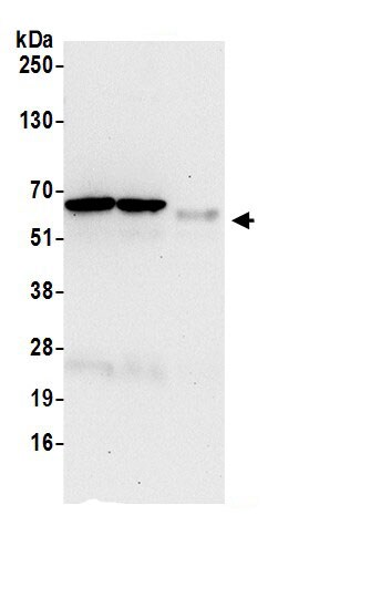 IF3EI Antibody