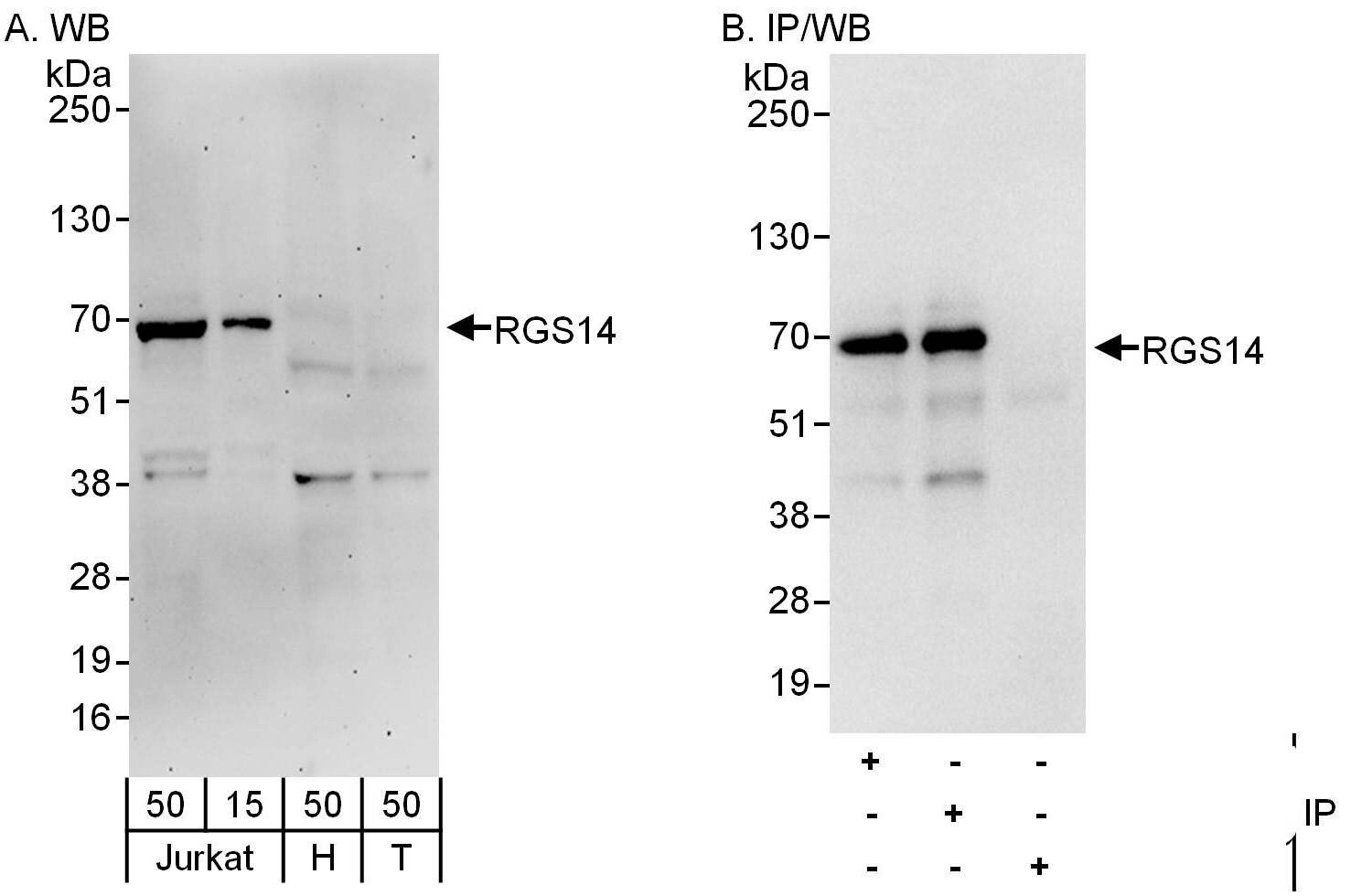 RGS14 Antibody
