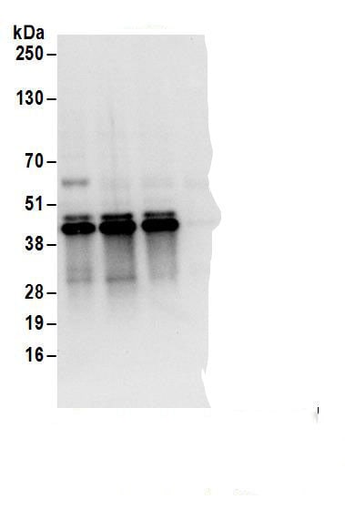UCH-L5/UCH37 Antibody