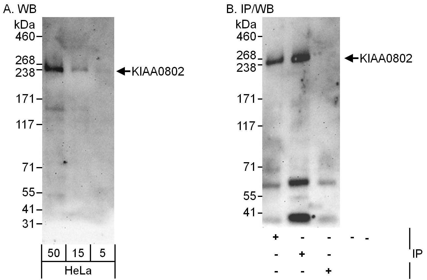 MTCL1 Antibody