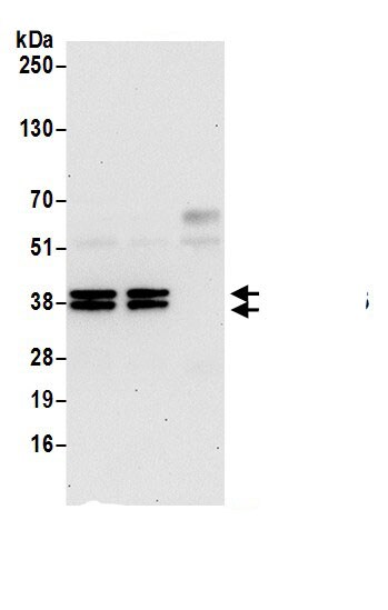 VTA1 Antibody