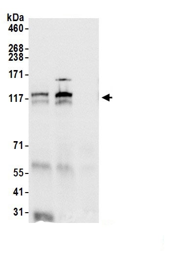 DNA Polymerase delta, catalytic subunit Antibody