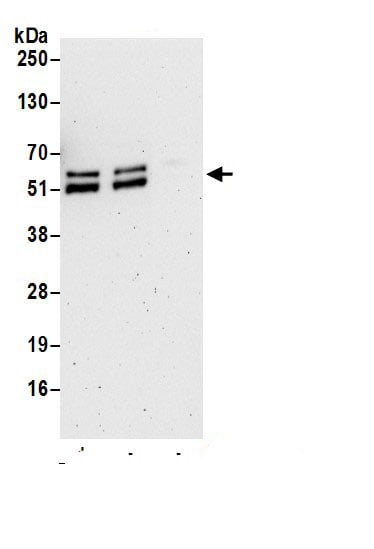 PPAR gamma/NR1C3 Antibody