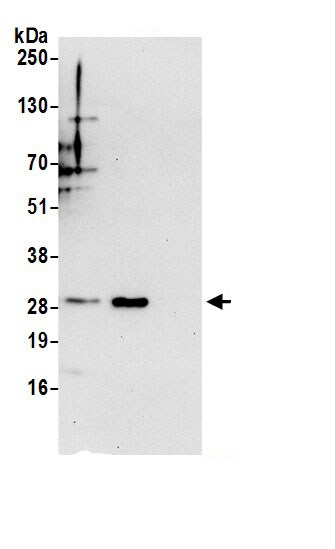 ETFB Antibody