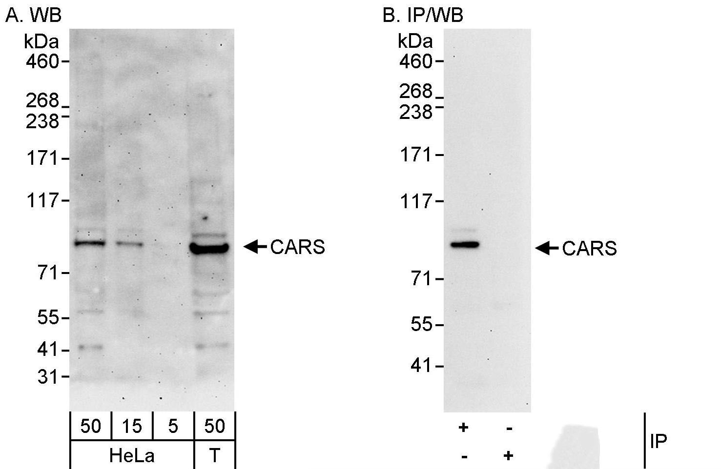CARS Antibody