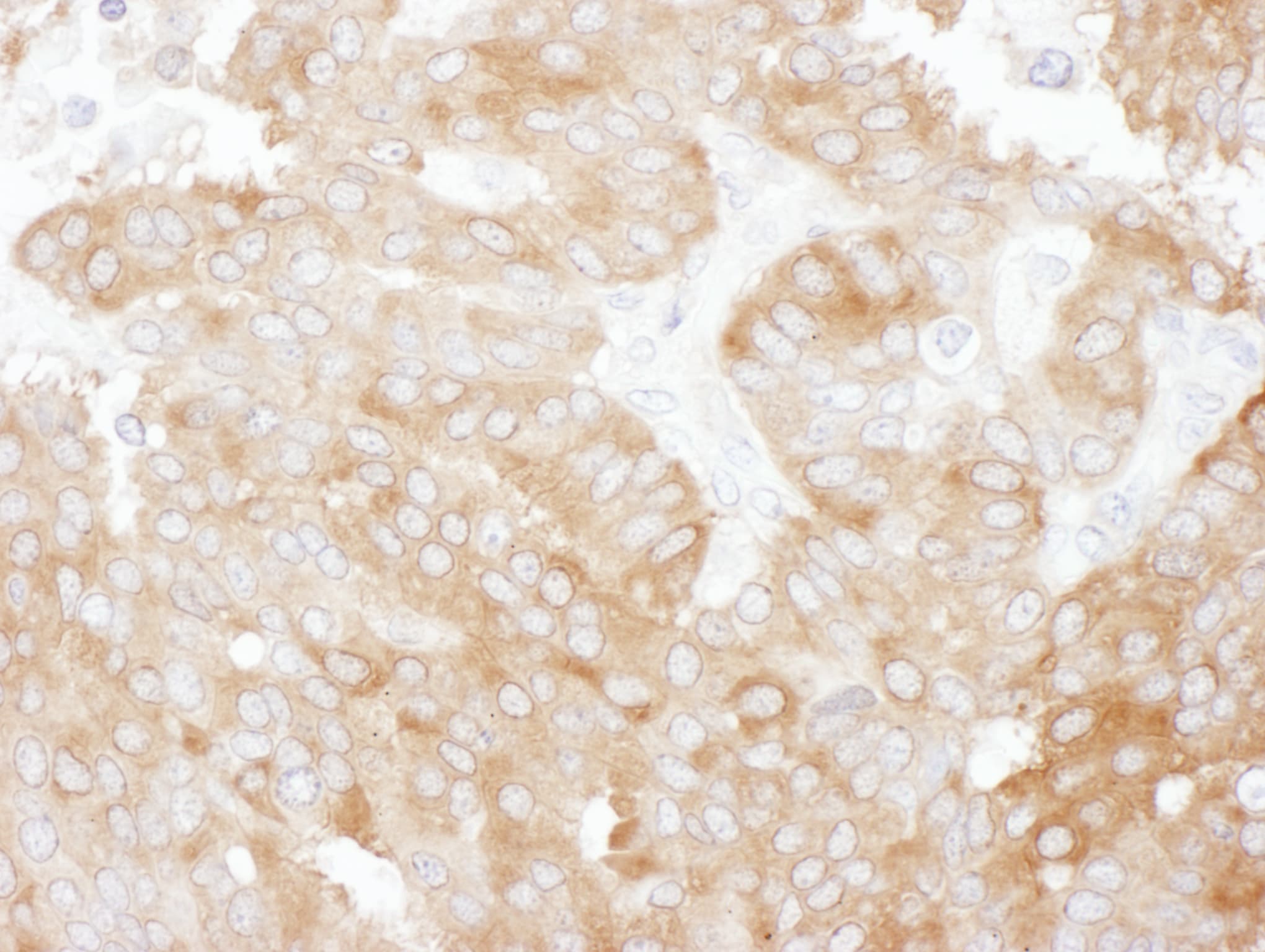 NHERF-1 Antibody