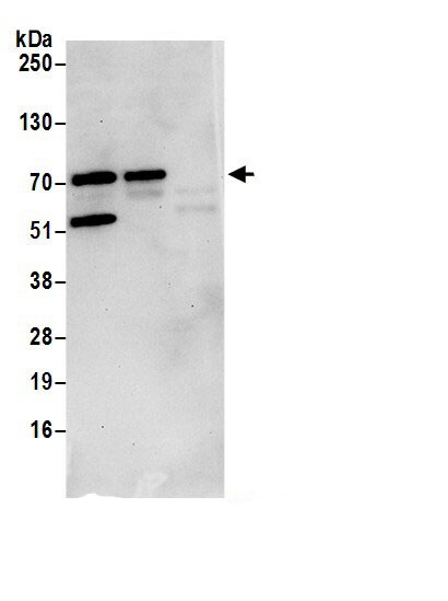 SLX4 Interacting Protein Antibody