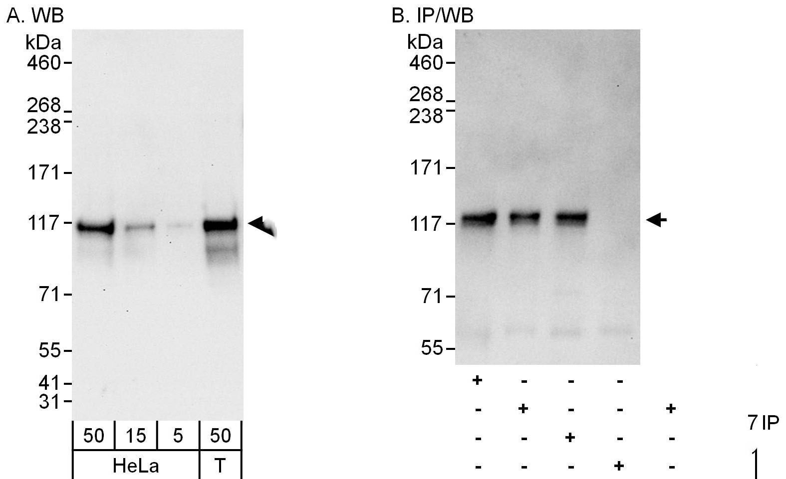 ANKLE2 Antibody