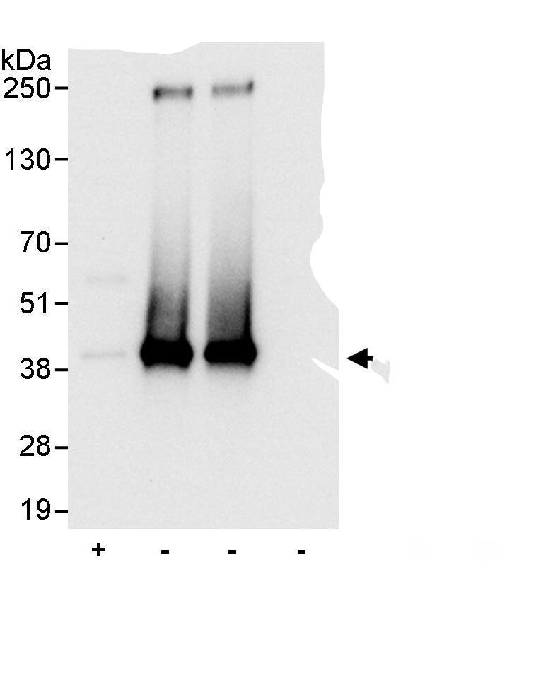 NPM1 Antibody