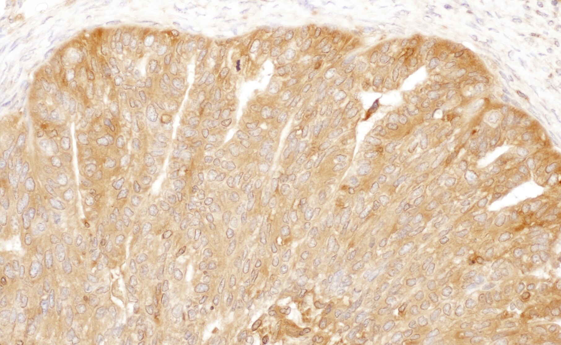 CAP1 Antibody