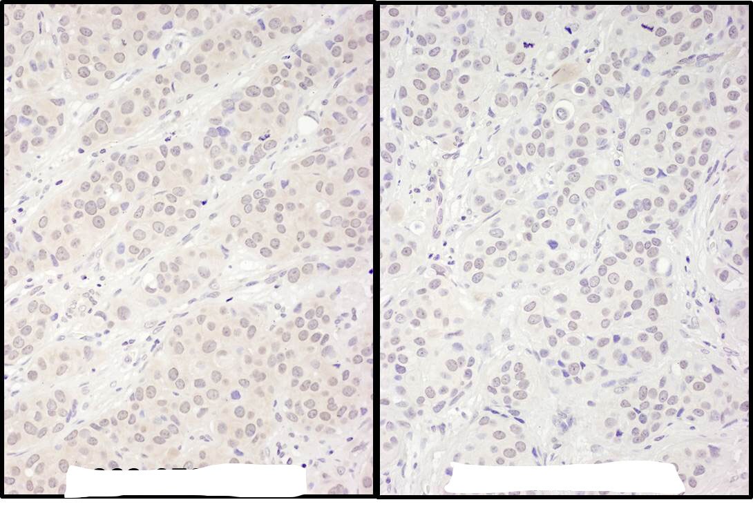 DDX56 Antibody
