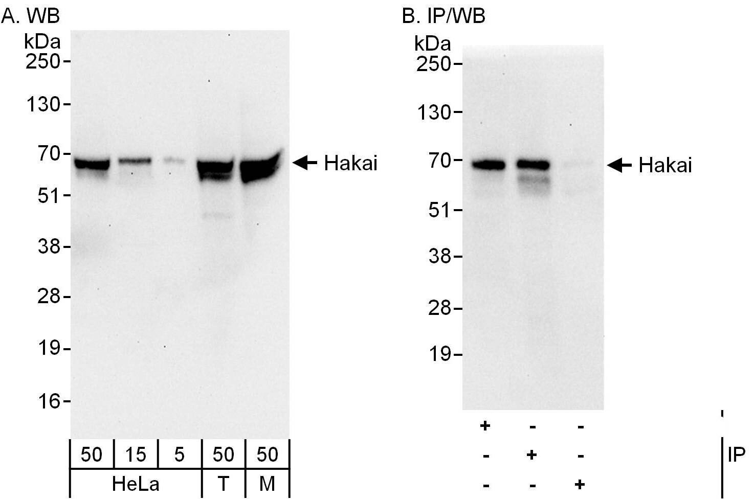 CBLL1 Antibody