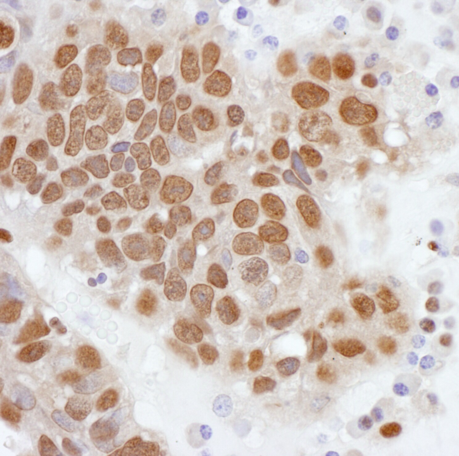 PCYT1A Antibody