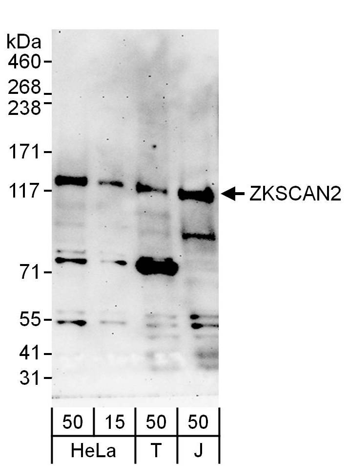 ZKSCAN2 Antibody