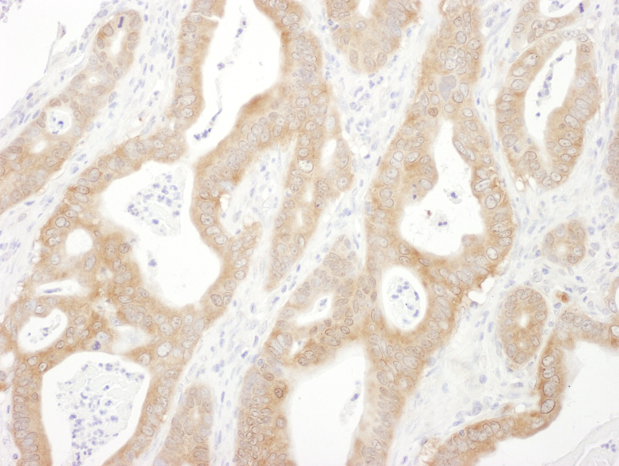 beta-Arrestin 1 Antibody