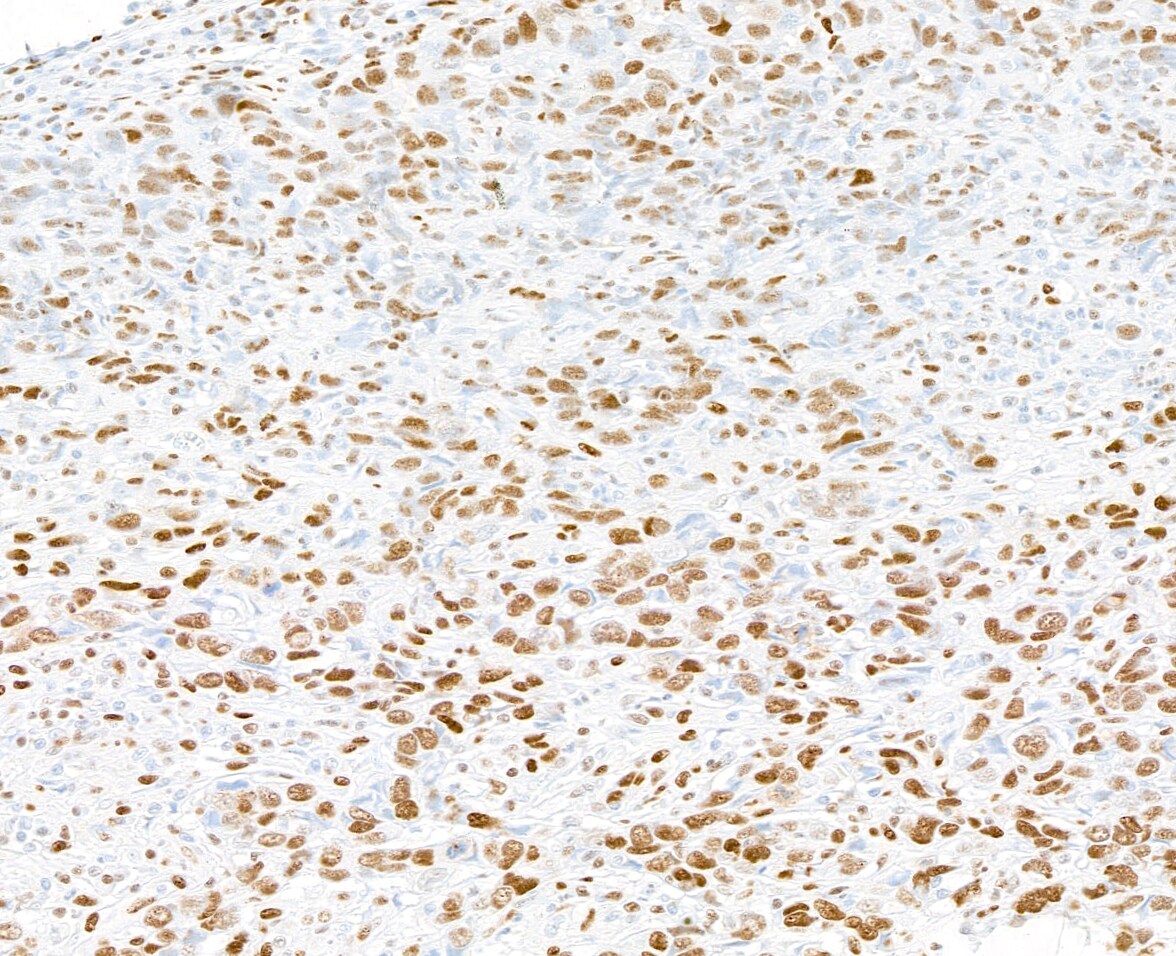 PML Protein Antibody