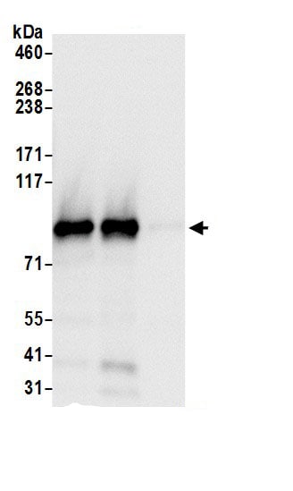 TBC1D5 Antibody