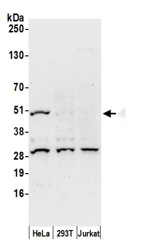 ACTR6 Antibody