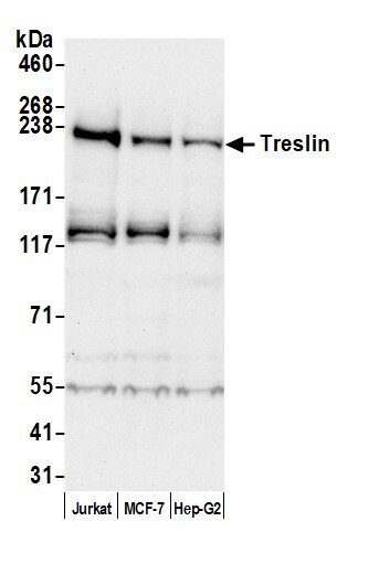 TICRR Antibody