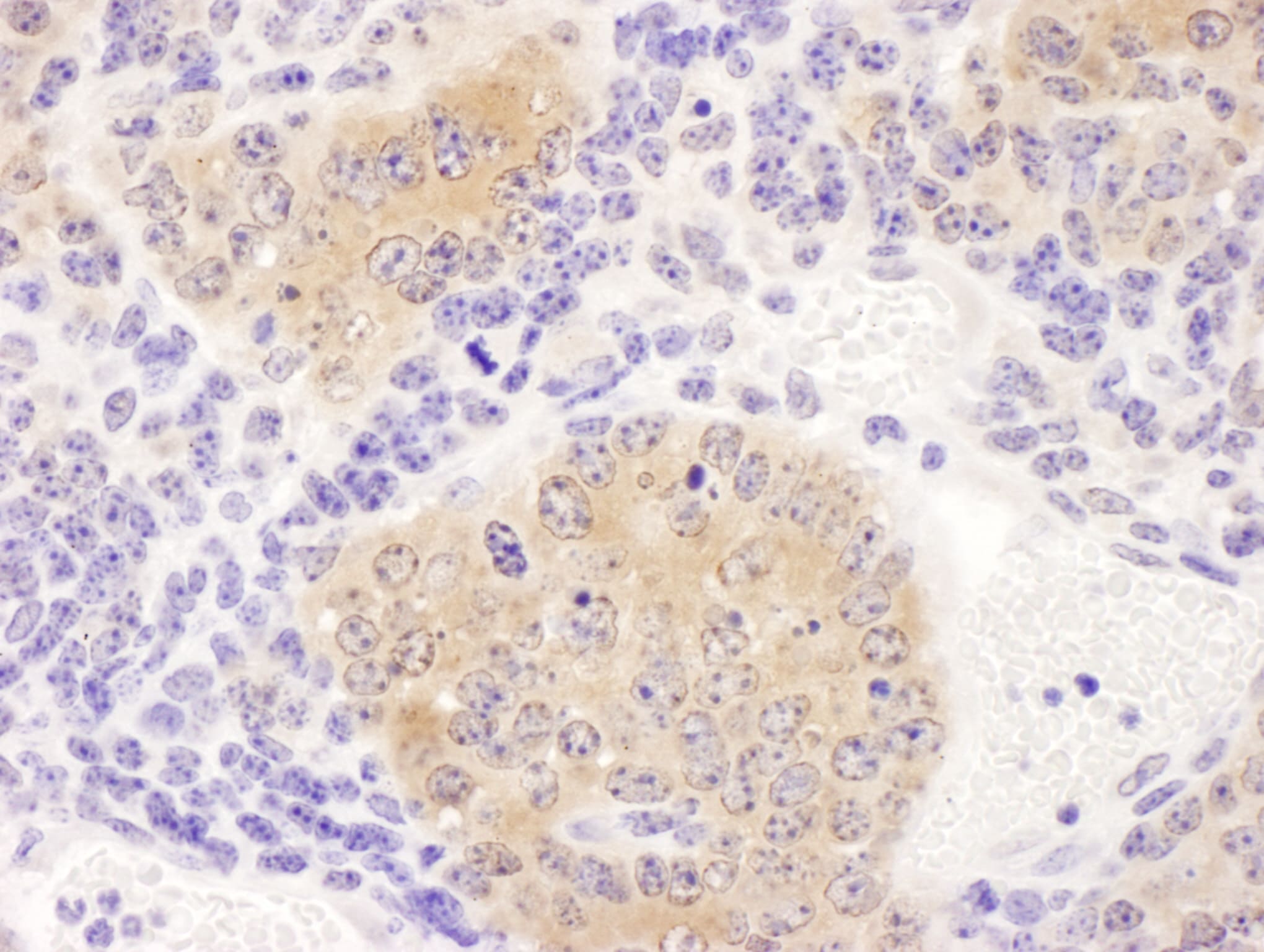 CCT8 Antibody