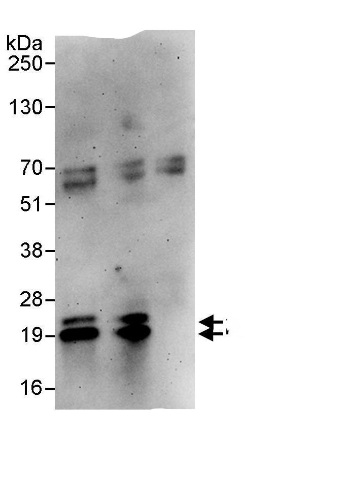 PPP1R14B Antibody