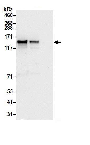 DIAPH3 Antibody