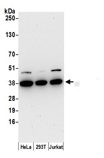 AKR1B1 Antibody