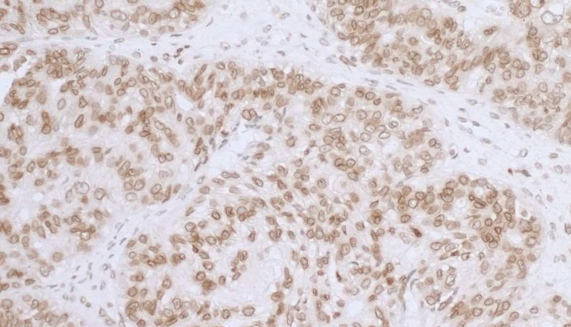 Thymopoietin/LAP2 Antibody