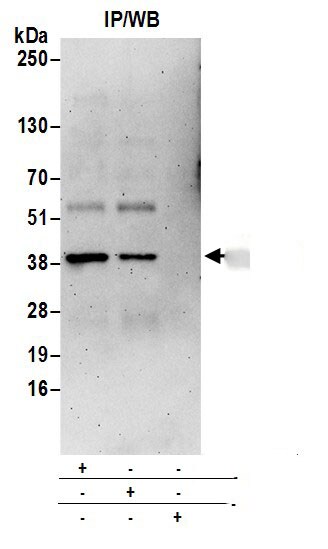 Biliverdin Reductase A/BLVRA Antibody