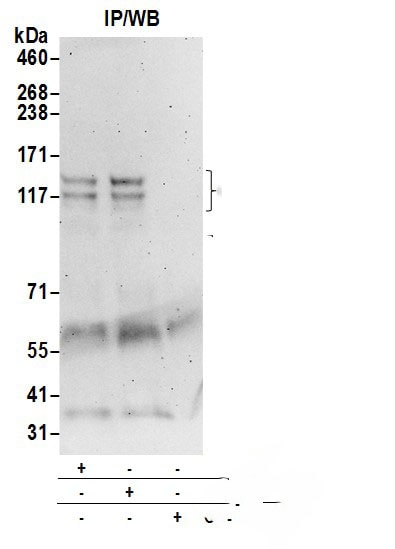 CDAN1 Antibody