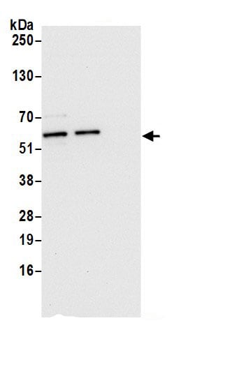 Fascin Antibody
