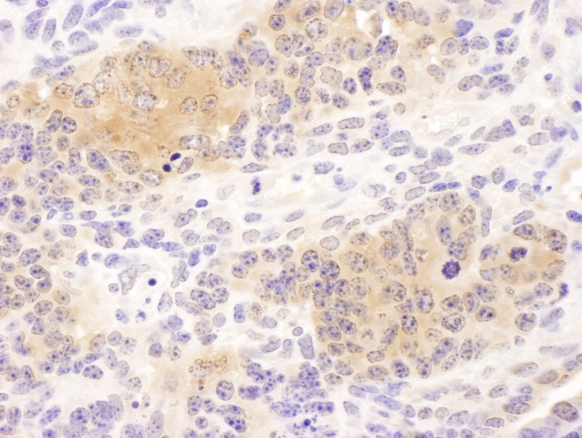 CCT8 Antibody