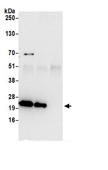 ATP5F1 Antibody