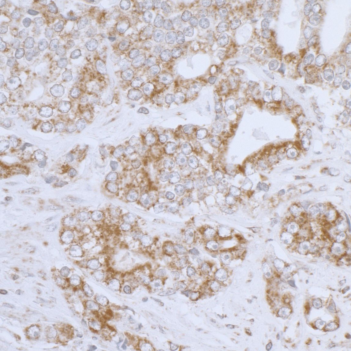 Dihydrolipoamide Dehydrogenase/DLD Antibody
