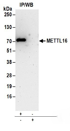 METT10D Antibody