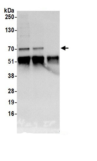 RNPC3 Antibody