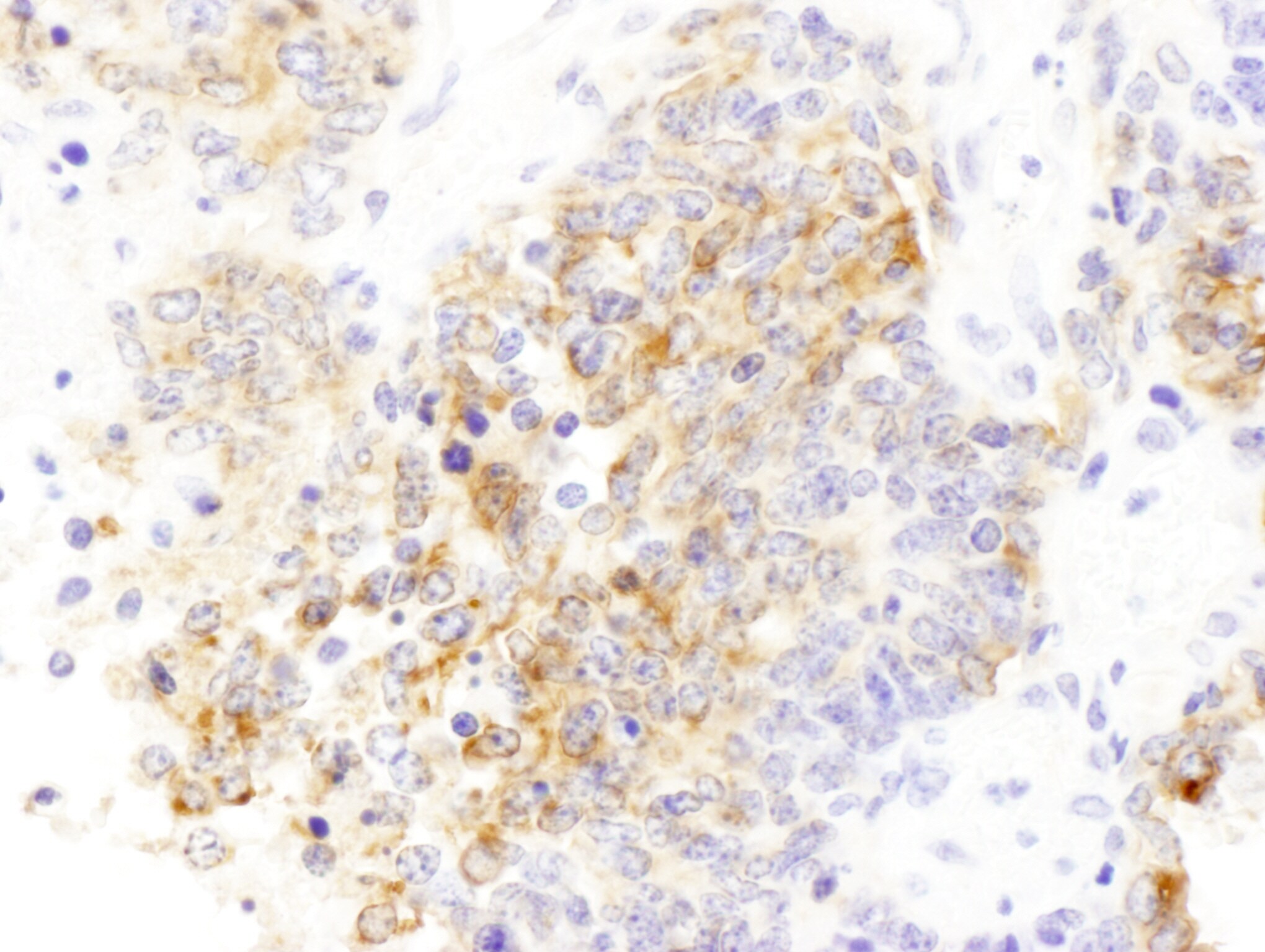 Drebrin 1 Antibody