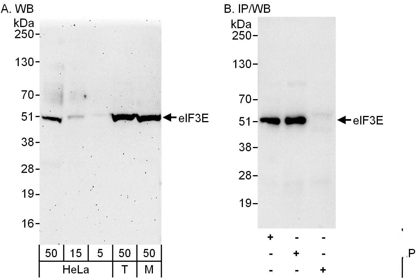 eIF3e Antibody