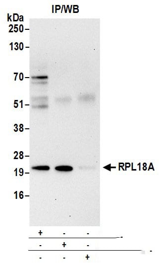 RPL18A Antibody