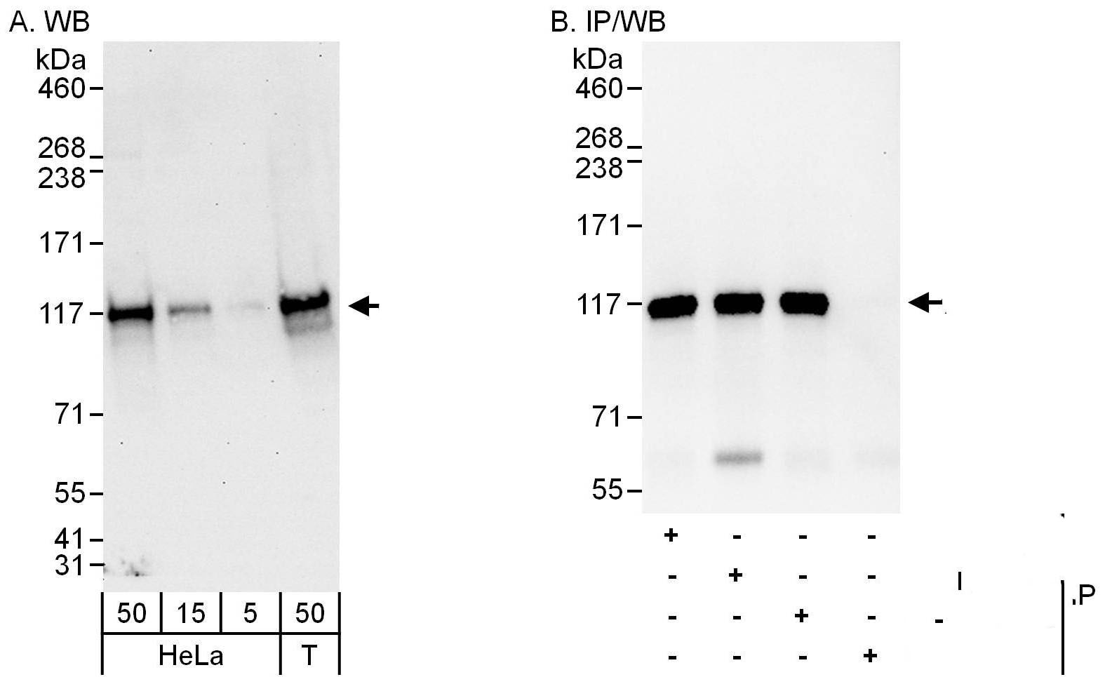 ANKLE2 Antibody