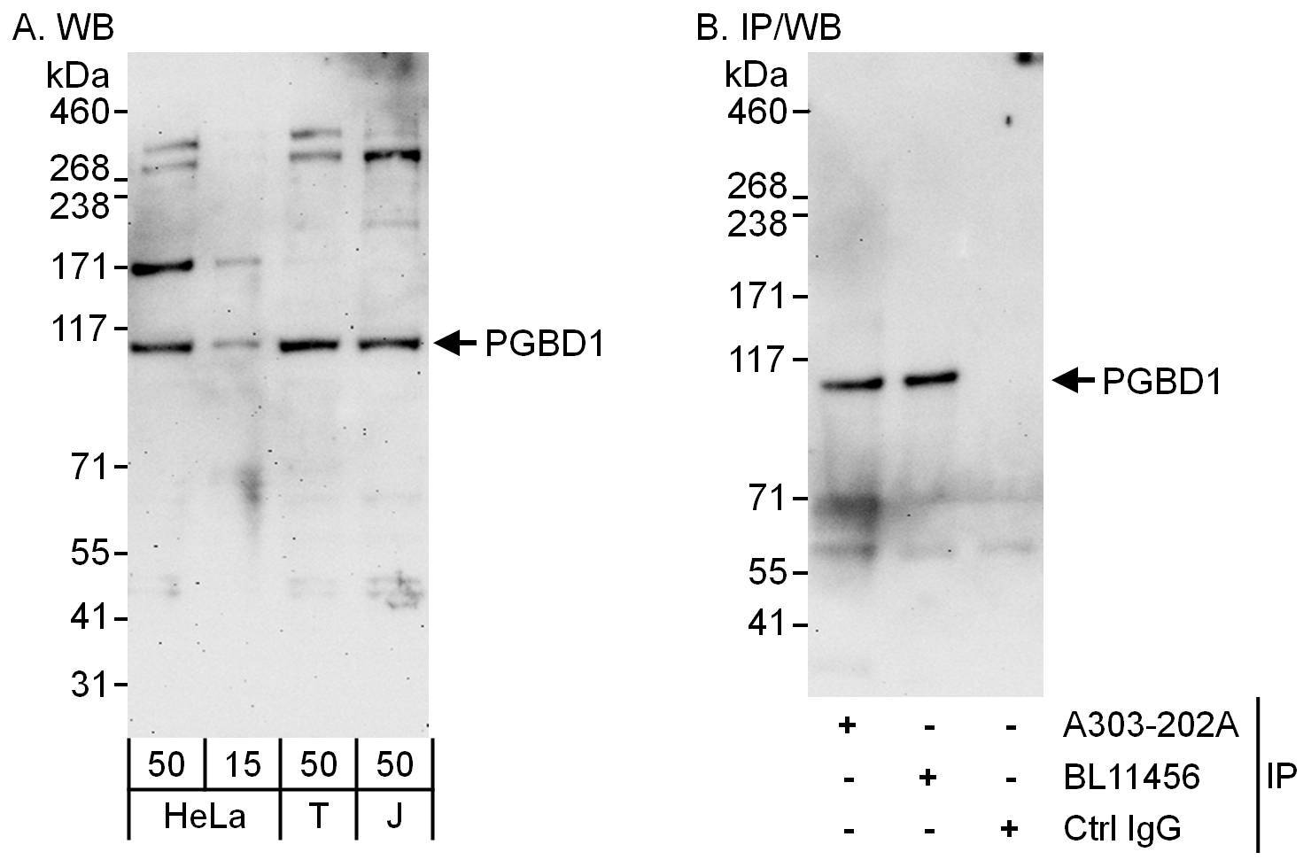 PGBD1 Antibody