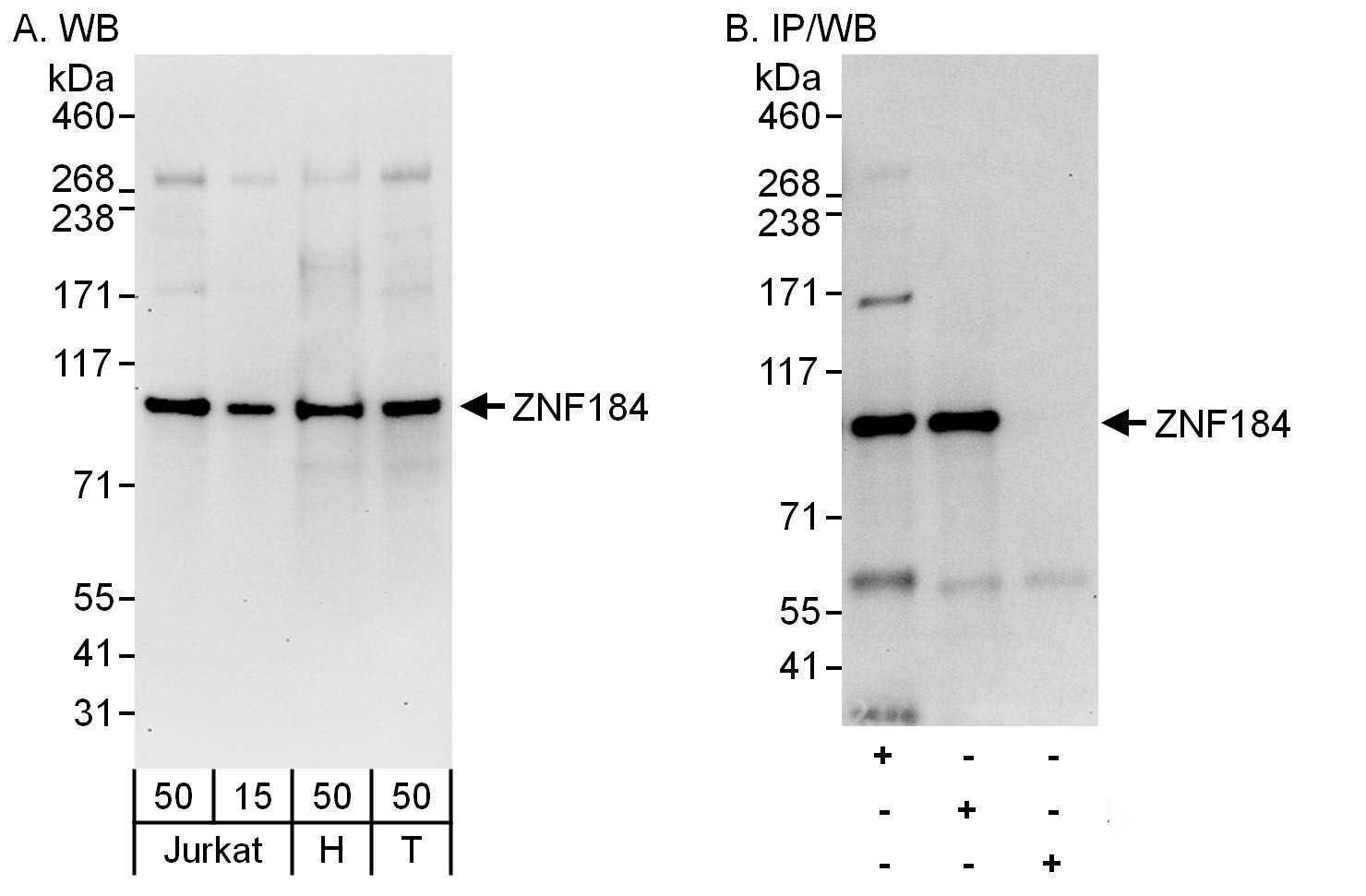 ZNF184 Antibody