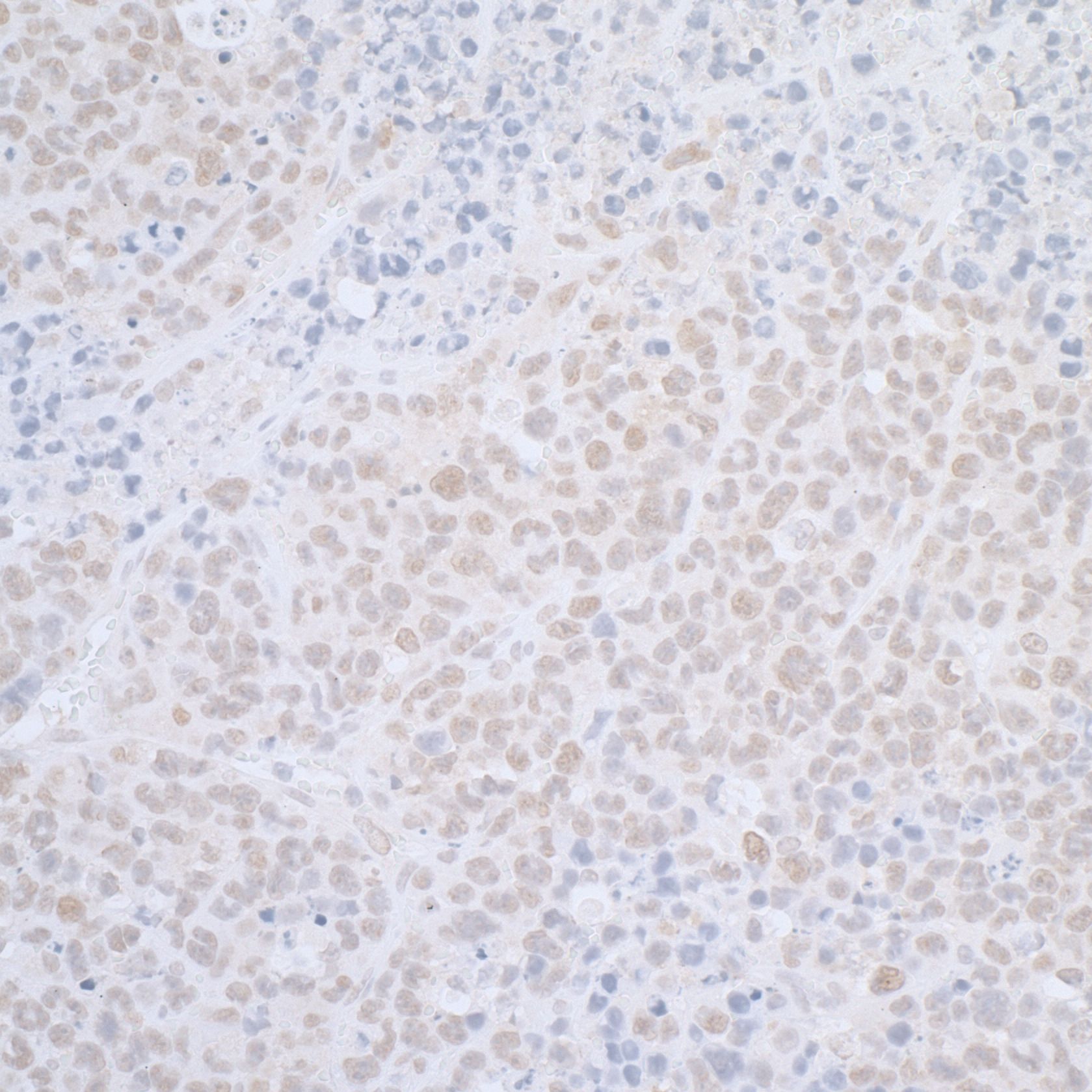 ELAC2 Antibody