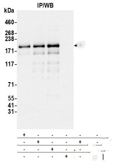Blooms Syndrome Protein Blm Antibody